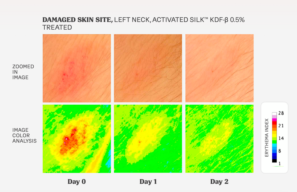 damage skin test results